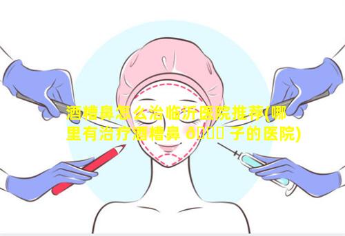 酒糟鼻怎么治临沂医院推荐(哪里有治疗酒糟鼻 🍁 子的医院)